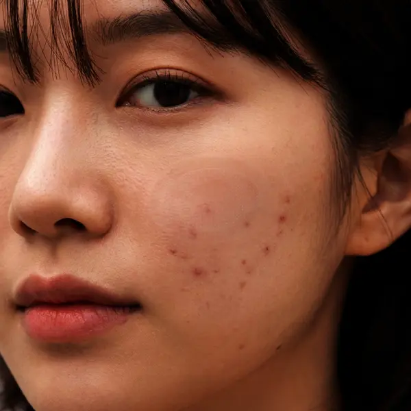 패치큐 화이트벨라 기미패치 검버섯 주근깨 잡티 흑자 제거 마이크로 니들 패치 12매입