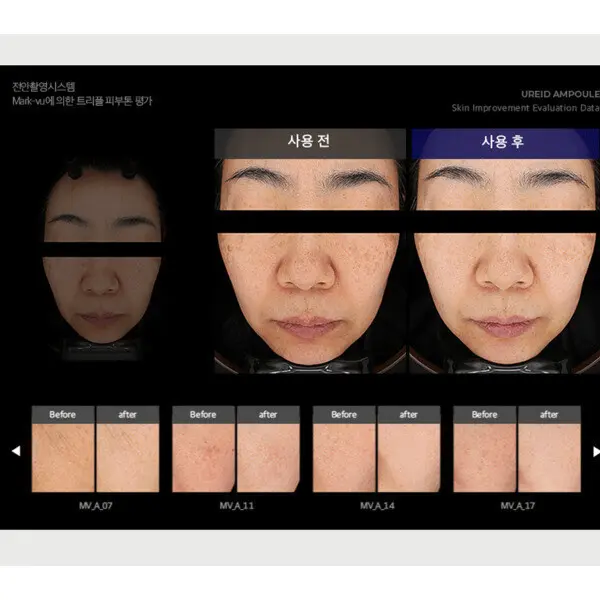 비에논 우레이드 앰플 나이아신아마이드 기미 잡티 미백앰플 3+1개